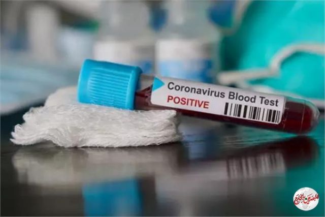 السعودية: ٤٧٢ إصابة جديدة بكورونا والإجمالي يرتفع الى 4934