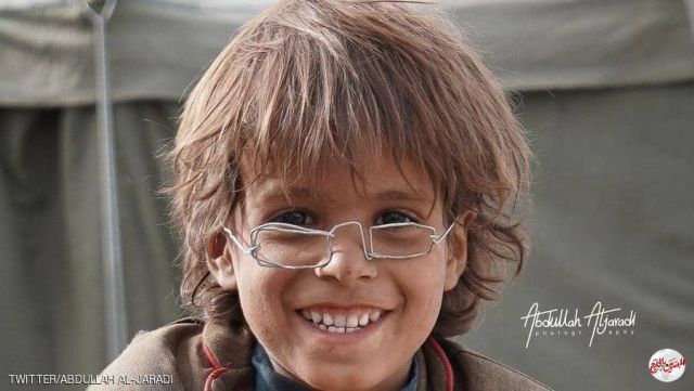 "نظارة" طفل نازح يمني تحقق 2.5 مليون ريال فى مزاد