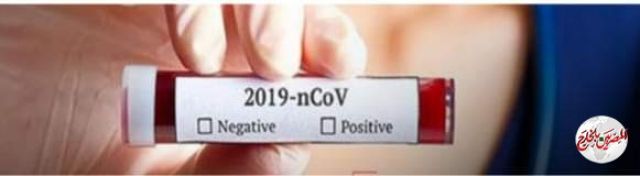 شركة أدوية عالمية بريطانية توفر مليار جرعة من لقاح كورونا