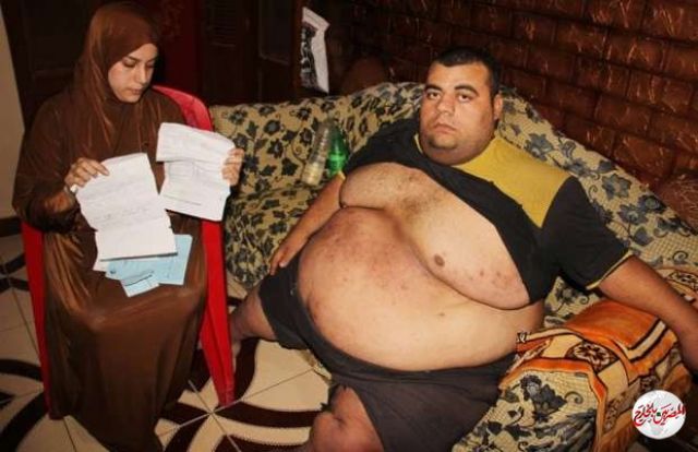 الرئيس السيسى يوجه بعلاج مواطن يعانى من السمنة المفرطة