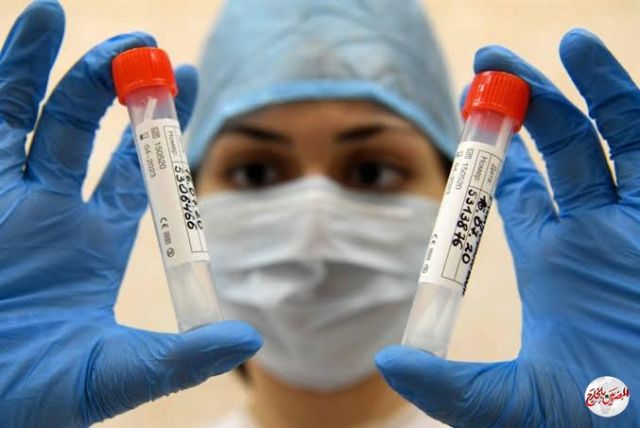 دولة عربية تتواصل مع روسيا بشأن لقاح كورونا.. تعرف عليها