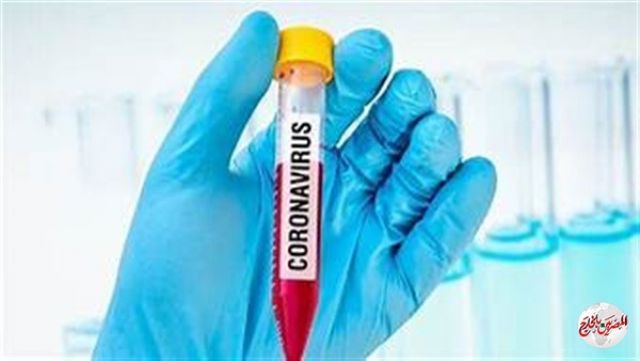 روسيا تنتج حوالي 300 ألف جرعة من لقاح فيروس كورونا بنهاية أكتوبر
